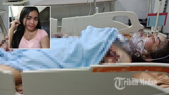 korban pembakaran pacar