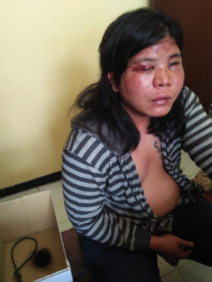 korban penganiayaan