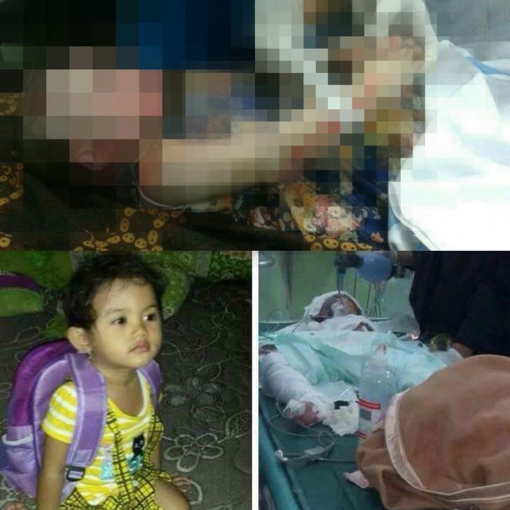 Intan Marbun Korban Bom Molotov HKBP Samarinda